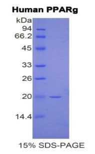 Human PPARG / PPAR Gamma Protein (Recombinant His)