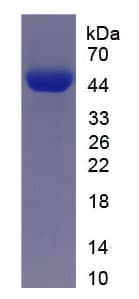 Mouse DKK3 Protein (Recombinant His-T7)