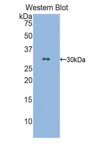 NAAA / ASAHL Antibody (aa112-359)
