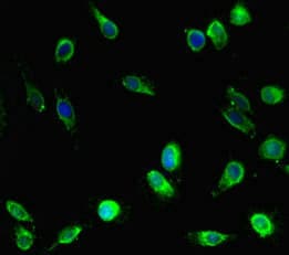EPM2A / Laforin Antibody