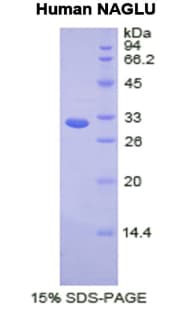 Human NAGLU Protein (Recombinant His-T7)