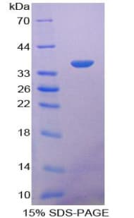 Mouse Prothrombin Fragment 1+2 Protein (Recombinant His-T7)
