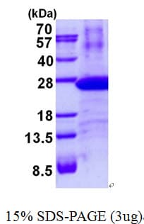 Human PSMB8 / LMP7 Protein (Recombinant His)