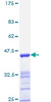 Human ESR2 / ER Beta Protein (Recombinant GST, N-terminus)