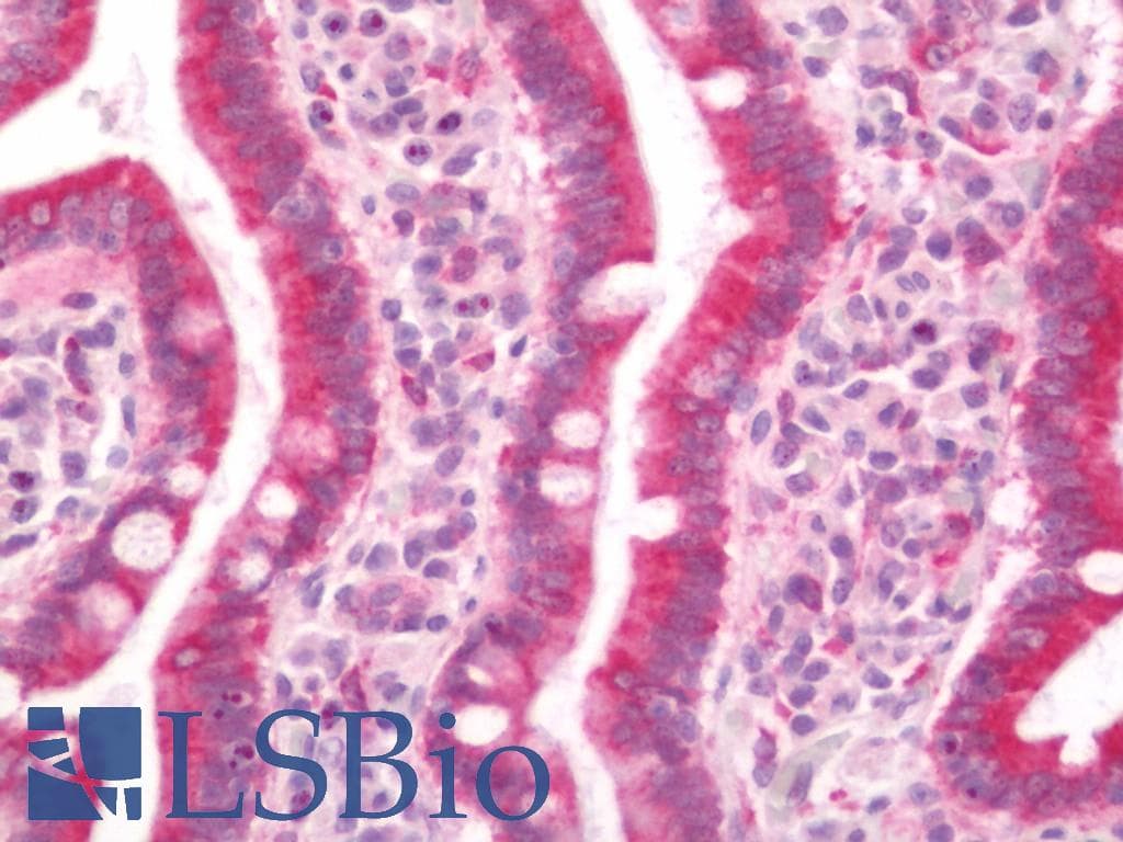 IHC-plus™ Polyclonal Rabbit anti-Human FZD9 / Frizzled 9 Antibody (aa542-591, IHC, IF, WB)