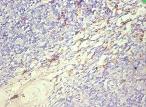 S100A8 / MRP8 Antibody (aa1-93)