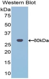 PHAP1 / ANP32A Antibody (aa2-249)
