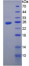Mouse IL12A / p35 Protein (Recombinant His-T7)