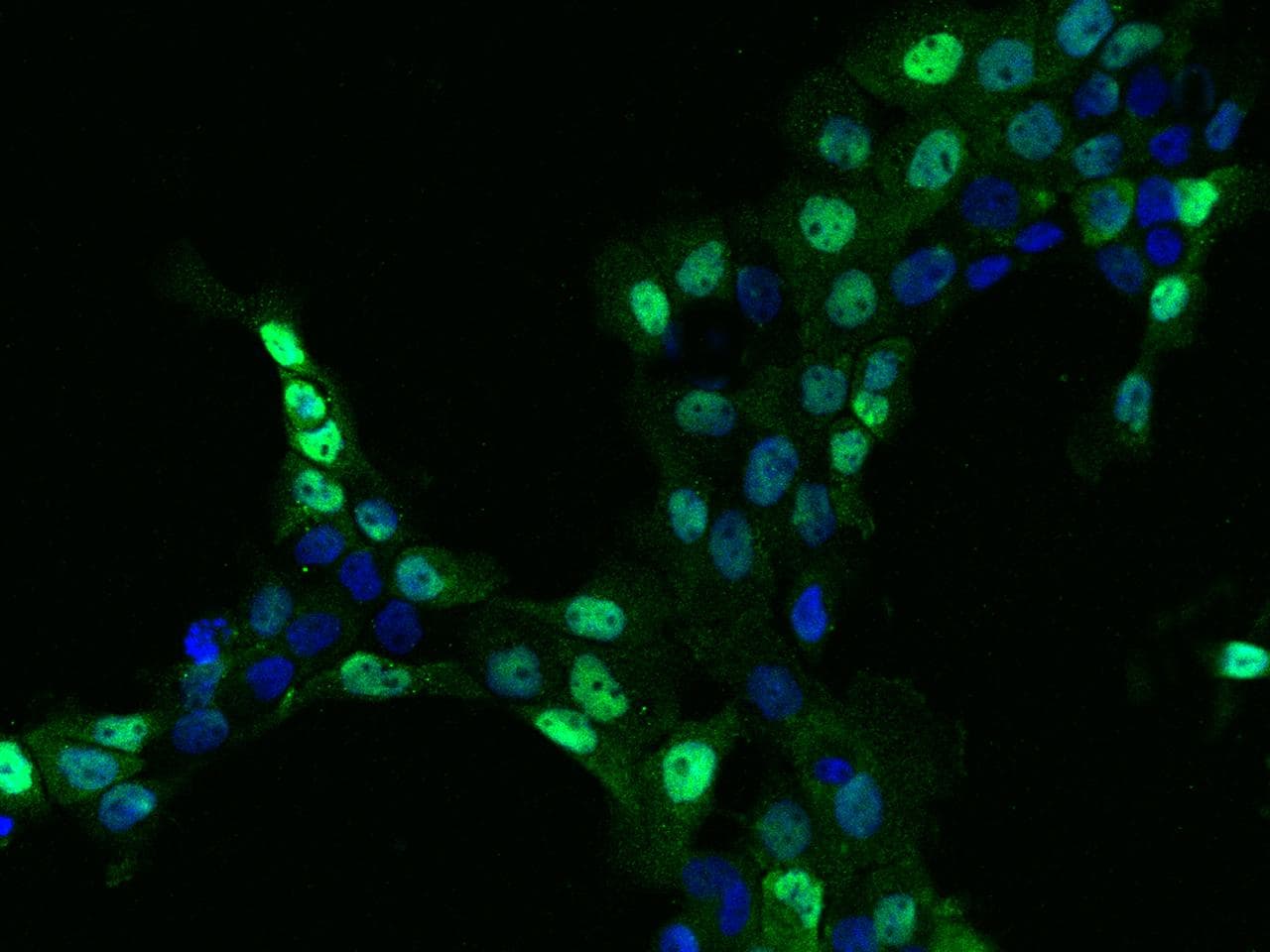 EWSR1 / EWS Antibody