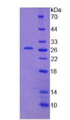 Human IFIH1 / MDA5 Protein (Recombinant His)