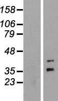 FOXR1 Protein (Over-Expression Lysate Myc-DDK (Flag))