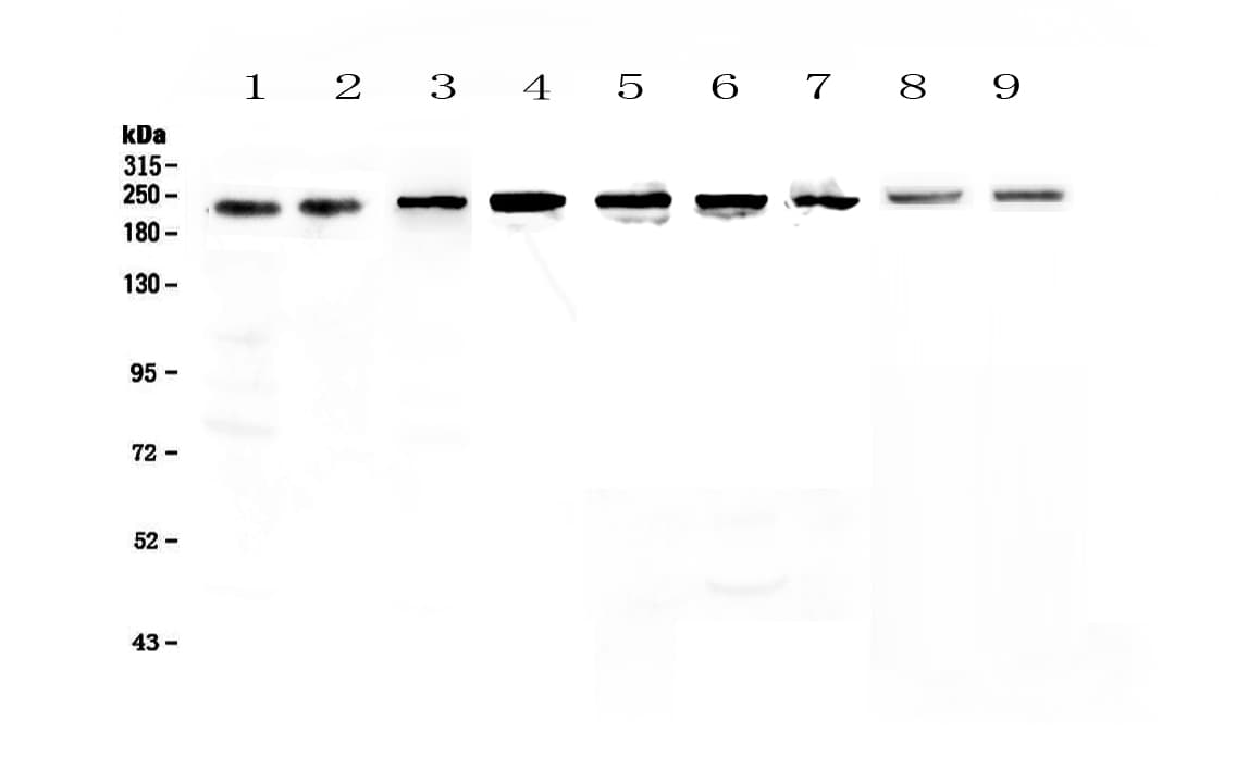 Polyclonal Rabbit anti-Human SMARCA4 / BRG1 Antibody (IHC, WB)