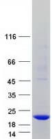 Human C14orf48 Protein (Recombinant Myc-DDK (Flag))