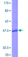 Human IL17F Protein (Recombinant GST)
