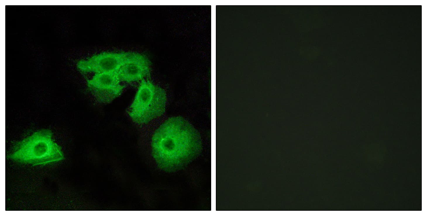 ADORA3 / Adenosine A3 Receptor Antibody (aa255-304)