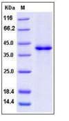 Human SDF1 / CXCL12 Protein (Recombinant Human IgG1 Fc, N-terminus)