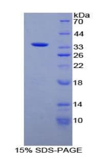 Human MMP7 / Matrilysin Protein (Recombinant His, N-terminus)