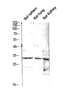 CALB1 / Calbindin Antibody