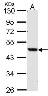 Polyclonal Rabbit anti-Human NR1H2 / LXR Beta Antibody (WB)