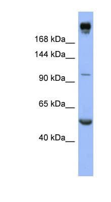Polyclonal Rabbit anti-Human INSR / Insulin Receptor Antibody (aa863-912, WB)
