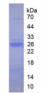 Pig Trypsin Protein (Native His, N-Terminal)