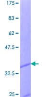 Human I-309 / CCL1 Protein (Recombinant GST)