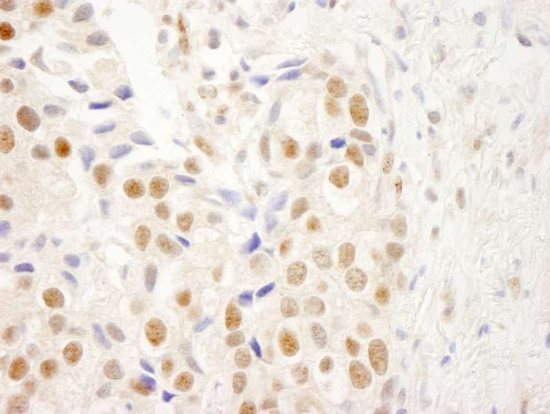 NRBF2 Antibody (aa125-175)