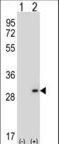 Dermatopontin / DPT Antibody (aa45-72)