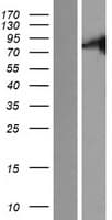 STKLD1 / SgK071 Protein (Over-Expression Lysate Myc-DDK (Flag))