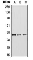 ARG1 / Arginase 1 Antibody (Internal)