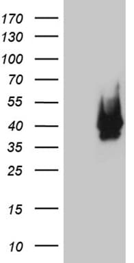 CDX1 Antibody (clone OTI2A5, Carrier-free)