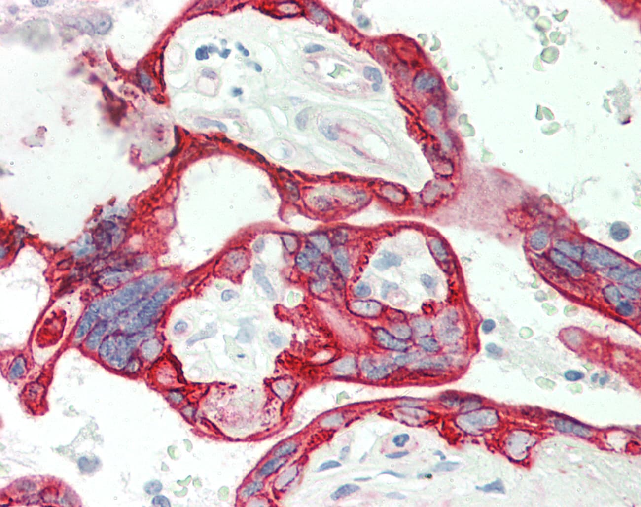 Polyclonal Rabbit anti-Human KRT6A / CK6A / Cytokeratin 6A Antibody (aa240-289, IHC, WB)