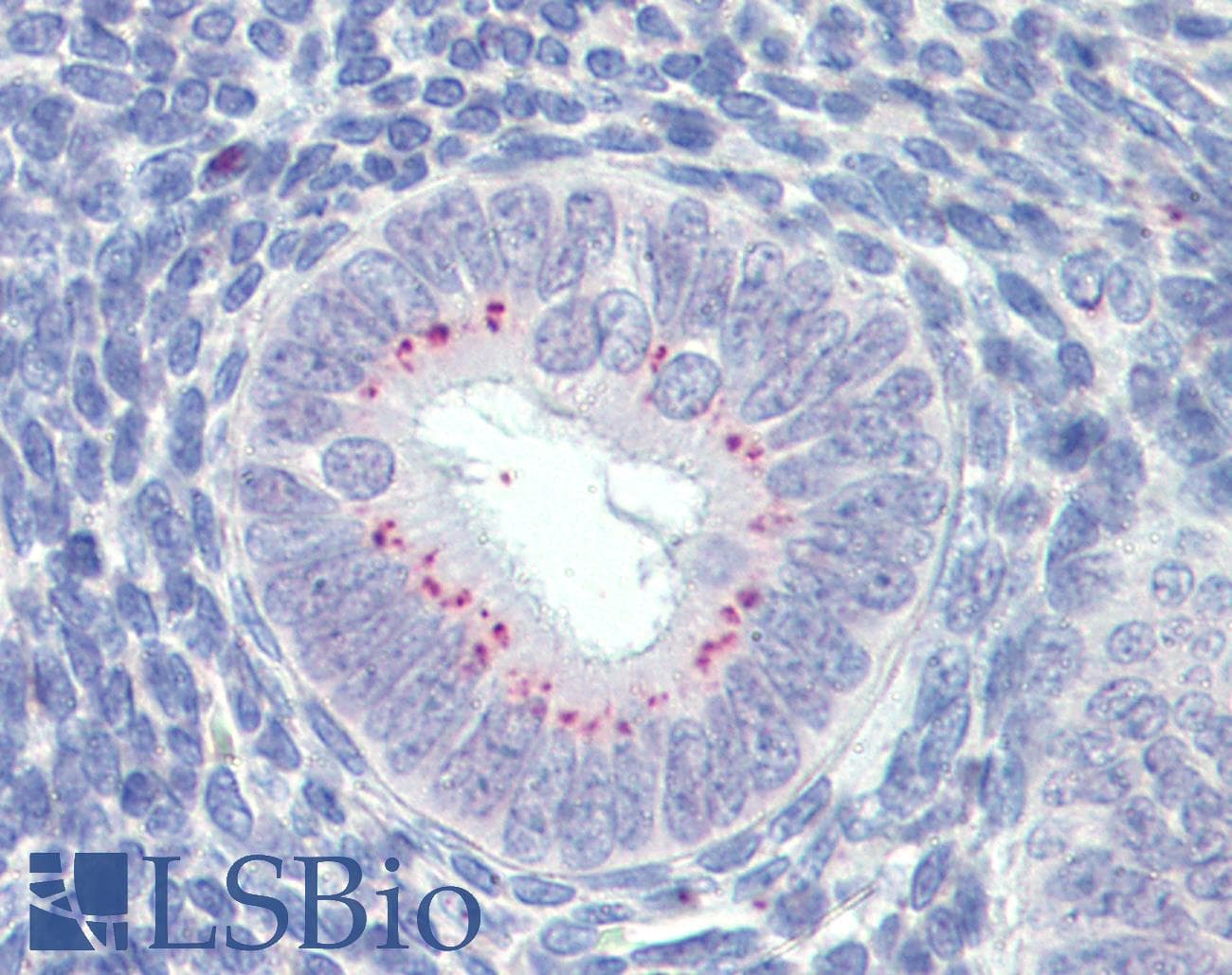 IHC-plus™ SFRP1 Antibody (aa171-183)