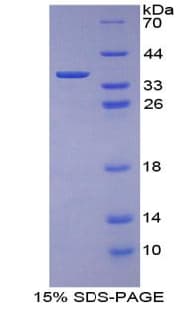 Mouse KRT1 / CK1 / Cytokeratin 1 Protein (Recombinant His)