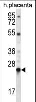 LHFPL1 Antibody (aa20-49)