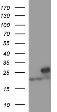 LZIC Antibody (aa1-190, clone OTI3A7)