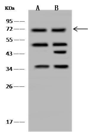 RNGTT / HCAP Antibody