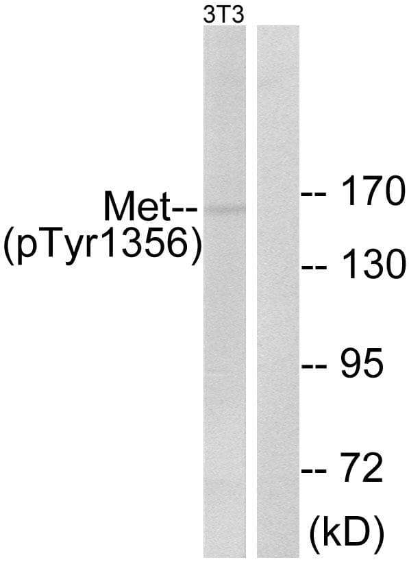 c-Met Antibody (phospho-Tyr1356)