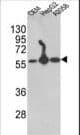 PDI / P4HB Antibody (aa436-464)