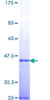 Human TSG101 Protein (Recombinant GST, N-terminus)