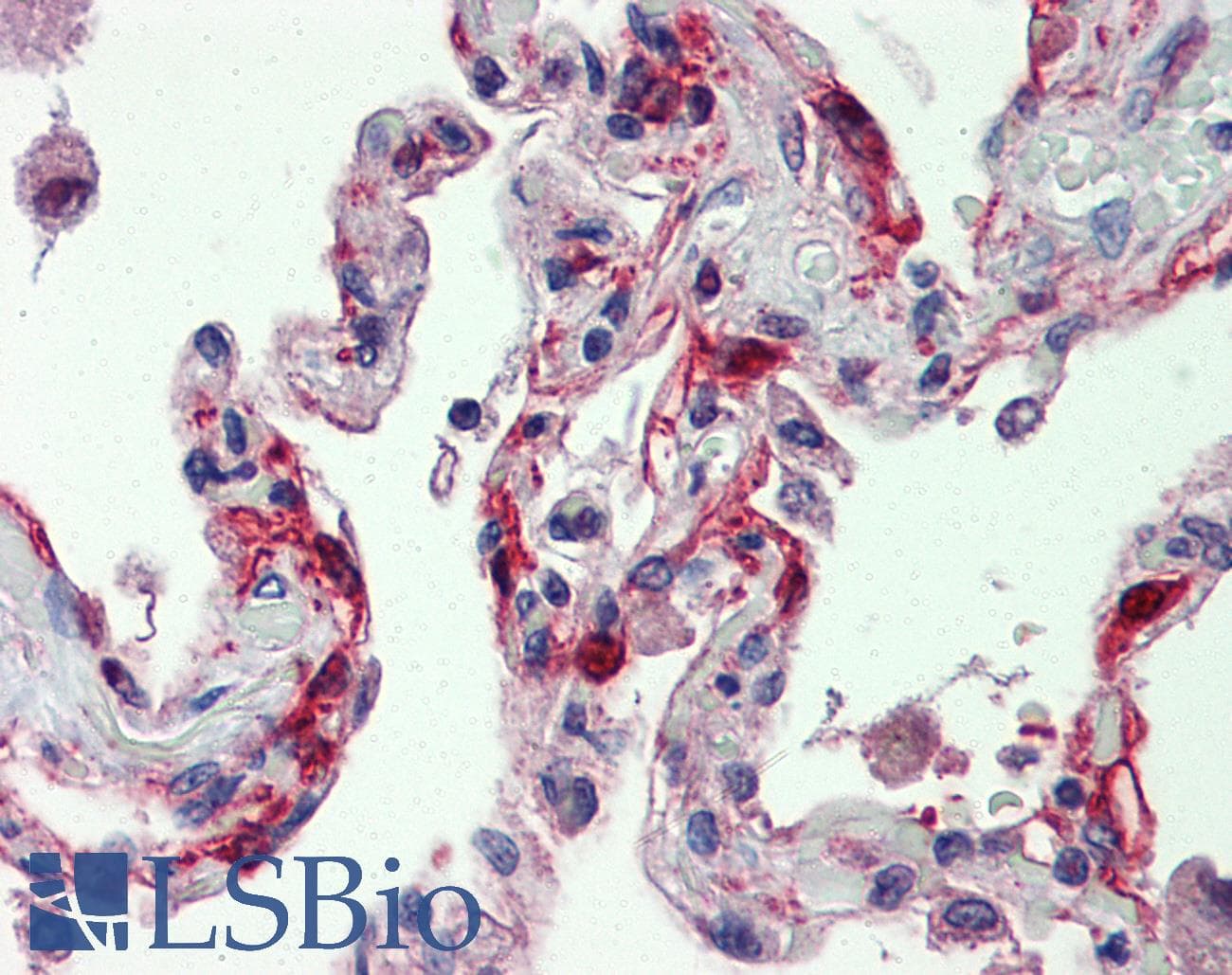IHC-plus™ Polyclonal Rabbit anti-Human F7 / Factor VII Antibody (IHC, WB)
