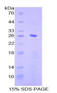 Human CD79B / CD79 Beta Protein (Recombinant His-T7)