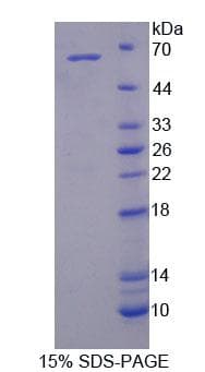 Rat IL6ST / CD130 / gp130 Protein (Recombinant His-GST, N-terminus)