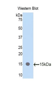 PPARA / PPAR Alpha Antibody (aa61-170, Cy3)