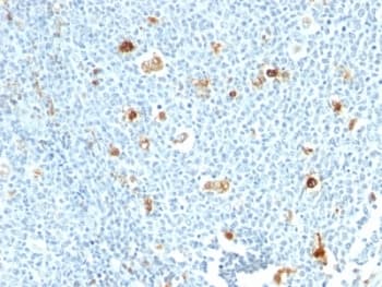 S100A9 / MRP14 Antibody (clone CPT/1028)