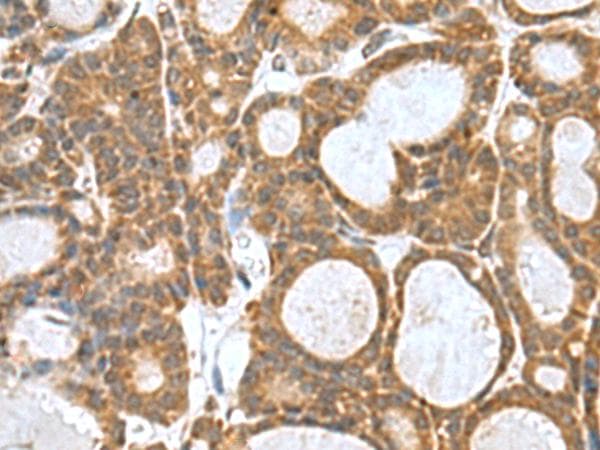 Polyclonal Rabbit anti-Human KANSL1L Antibody (IHC)