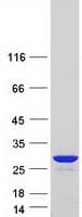 Human PRDX1 / Peroxiredoxin 1 Protein (Recombinant Myc-DDK (Flag))
