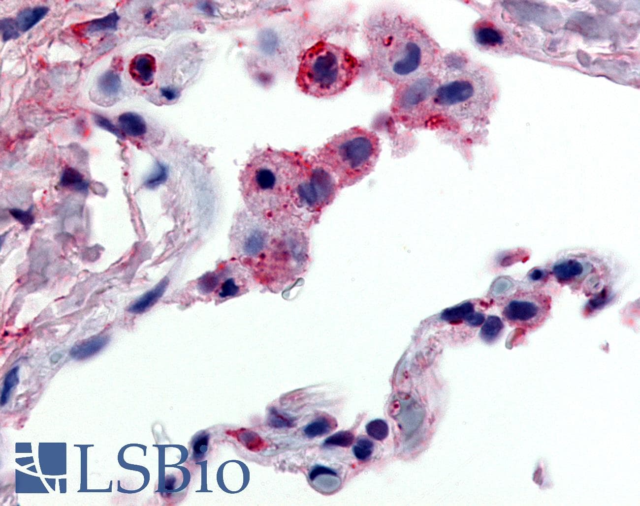 IHC-plus™ FFAR2 / GPR43 Antibody (C-Terminus)