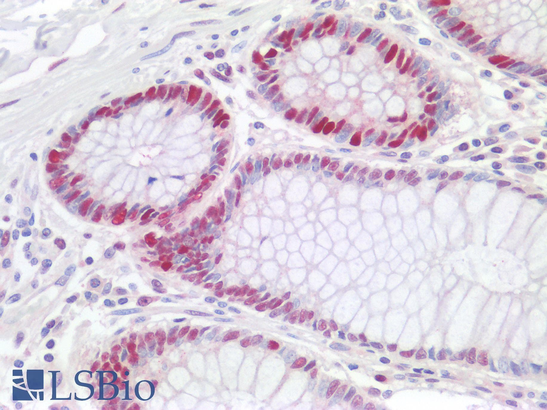 PathPlus™ PCNA Antibody