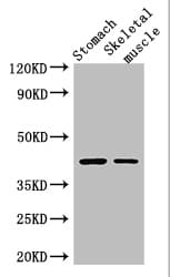 AGTR1 / AT1 Receptor Antibody